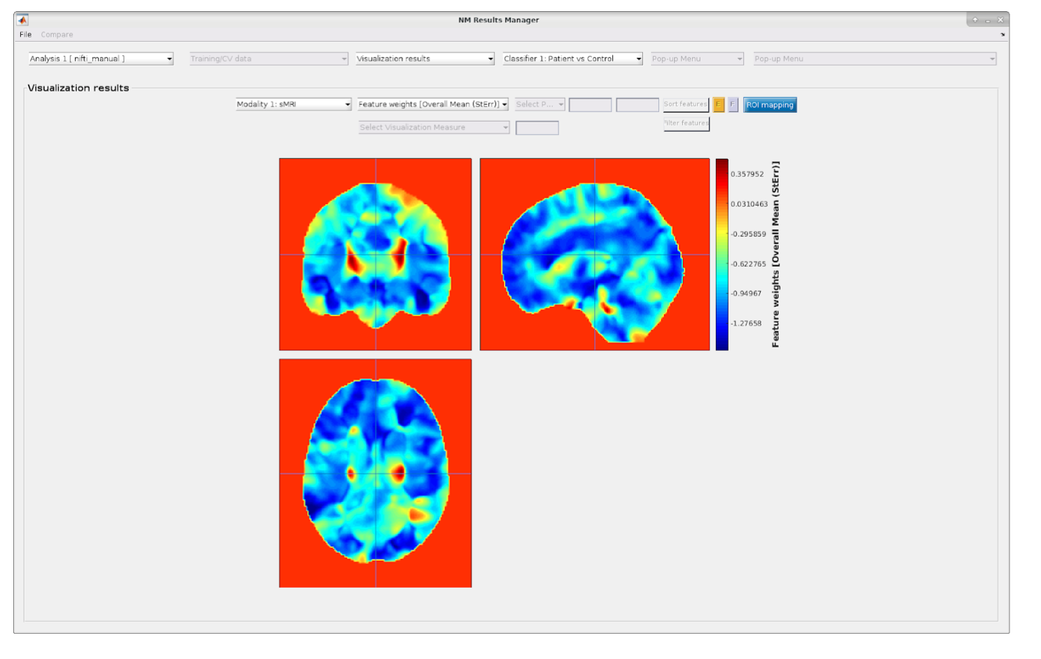 Neurominer result viewer, visualization results