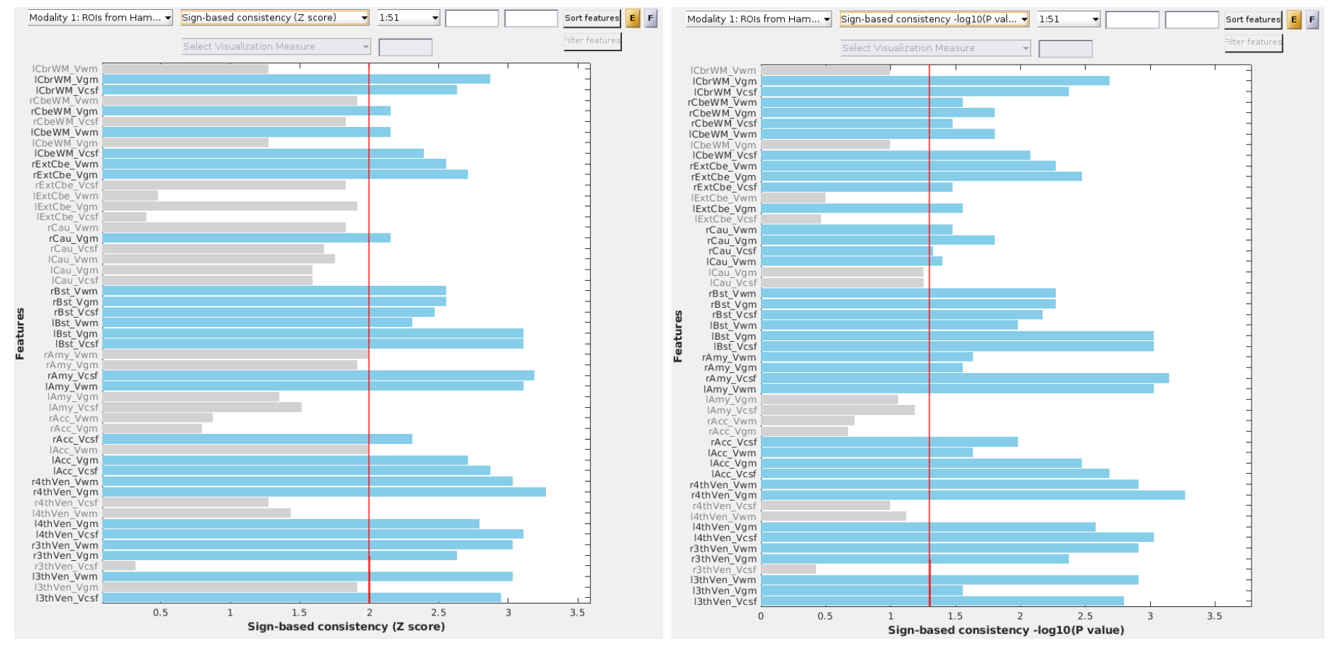 Neurominer result viewer, visualization results