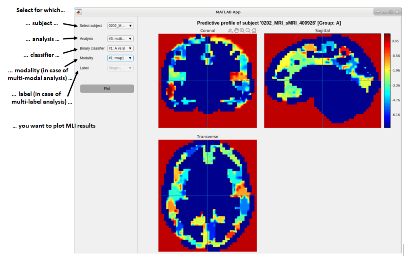 Neurominer result viewer, visualization results mli